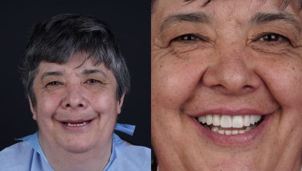 caso-clinico-digitalArch-i2-implantologia-3