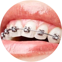 brackets-metalicos
