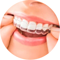 invisalign
